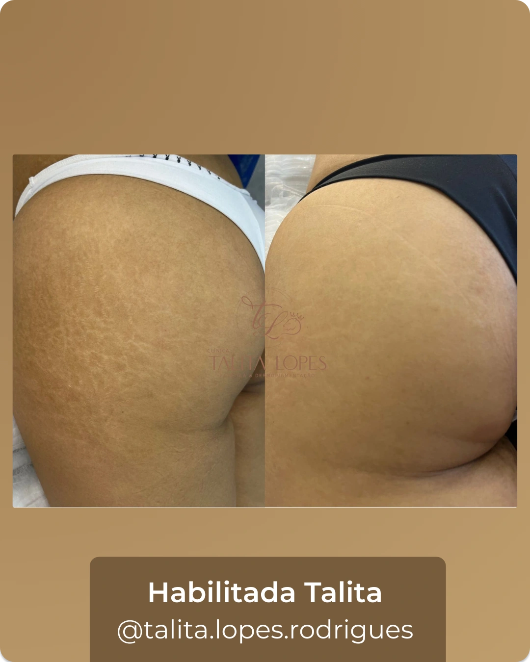 1_2