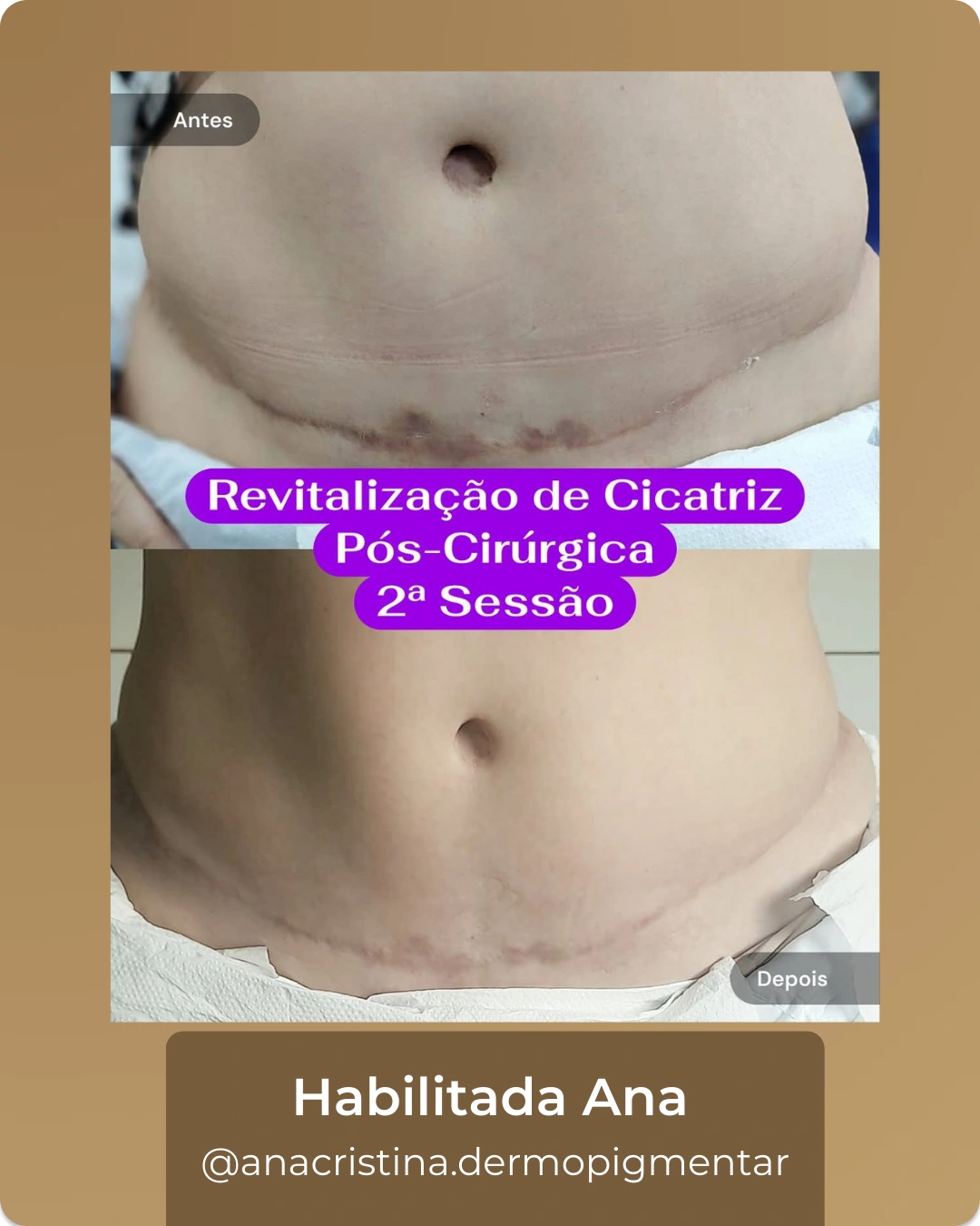 4_2