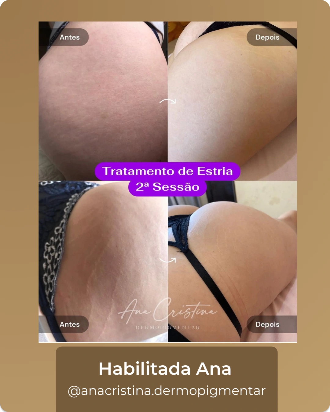 5_2