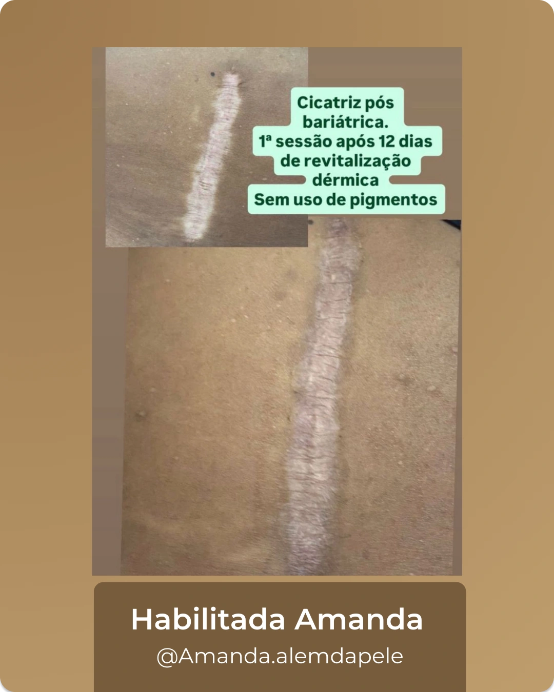 6_2